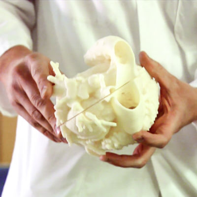 Lääkärin käsissä potilaan sydämestä tehty 3d-malli.