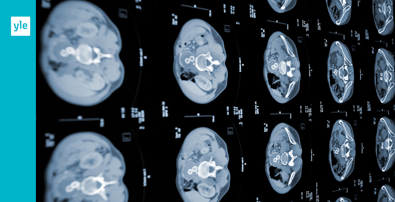 Skillnad Mellan Datortomografi Och Skiktröntgen
