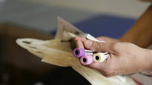 polycytemia vera ärftlighet polycytemia vera ärftlighet
