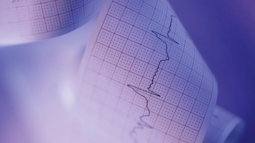 hjärta dubbelslag orsak hjärta dubbelslag orsak