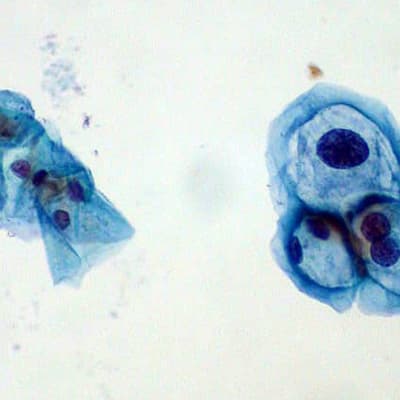 HP-virus