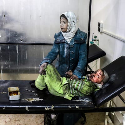 Haavoittunut lapsi makaa tutkimuspöydällä äidin pidellessä häntä.
