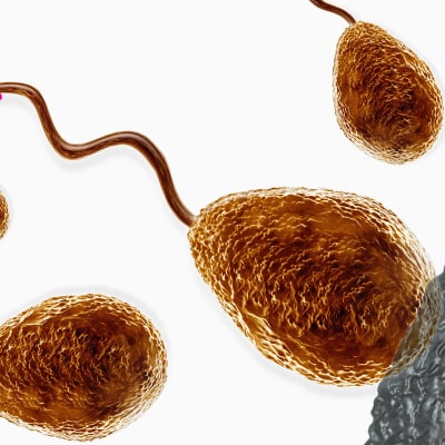 illutsrerad bild av spermier