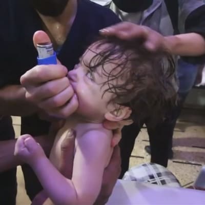 Litet barn får medicin efter en misstänkt kemvapenattack mot staden Douma i Syrien.