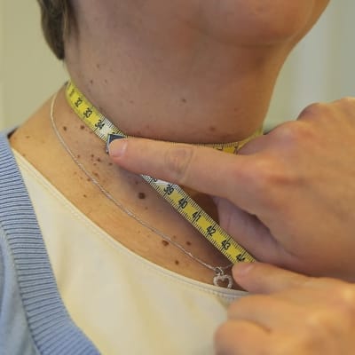 Professori Terhi Piltonen mittaa toimittajan kaulaa.