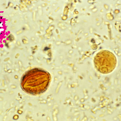 en när bild på cystor bakterie