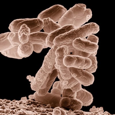 E-coli bakteeri, johon ESBL voi tarttua