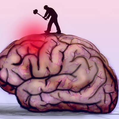 Kuvassa aivot, jota pieni mies moukaroi - kertoo stressin vaikutuksesta aivoihin.