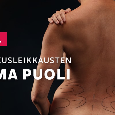 Kauneusleikkausten ruma puoli -jakson julistekuva. Kuvassa henkilön selkään on piirretty viivoja.