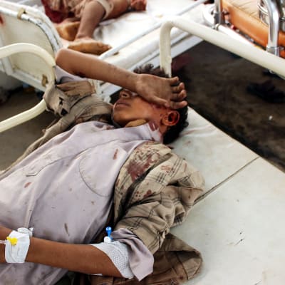 Iskussa haavoittunut lapsi sairaalassa Jemenissä 9. elokuuta.