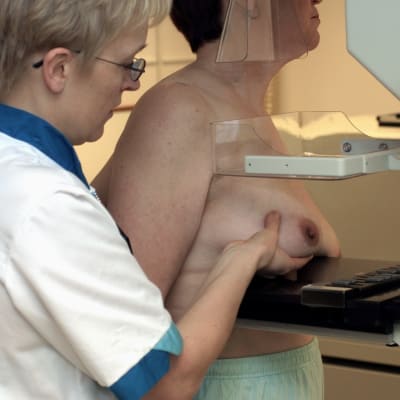 mammografi för bröstcancer