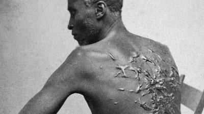 Gordon- niminen paennut orja näyttää ruoskittua selkäänsä kameralle Lousianassa vuonna 1963.