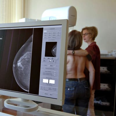 Mammografiakuvaus.
