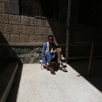Iskuissa invalidisoitunut jemeniläismies odotti pääsyä hoitoon kuntoutuskeskuksessa Sanaassa 22. lokakuuta 2016. 
