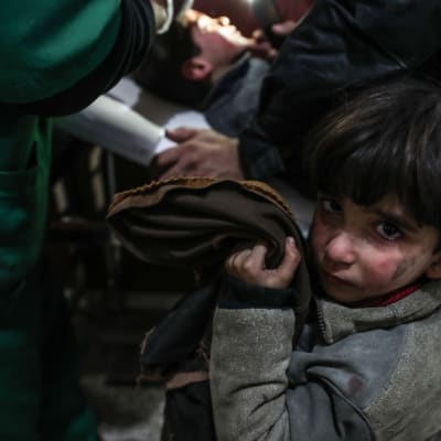 Tyttö loukkaantuneen veljensa vieressä, joka on saamassa ensiapua sairaalassa pommitusten jälkeen Doumanin kaupungissa, Itä-Ghoutassa.