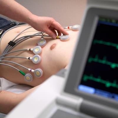 Potilaan sydänsähkökäyrää mitataan EKG-laitteella.