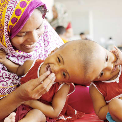 Siamilaiset kaksoset Rabeya ja Rukaya äitinsä Taslima Khatunin kanssa sairaalassa Dhakassa 28. heinäkuuta 2017.