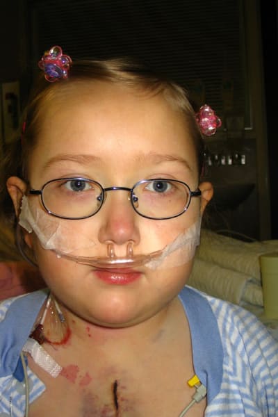Ett barn med glasögon och toffsar i håret. Hon har ett stort ärr som går över bröstkorgen och syrgasslang i näsan. 
