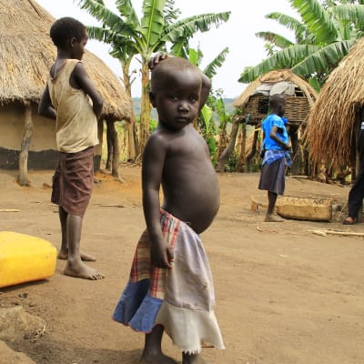 Nälkää ei Ugandan pakolaisasutusalueilla nähdä, mutta ravintoarvot voivat olla alhaisia. Suuri osa pakolaisista etenkin kongosta tulevat köyhistä oloista maaseudulla, ja elämä pakolaisasutusalueilla on monella tapaa samanlaista kuin kotona.