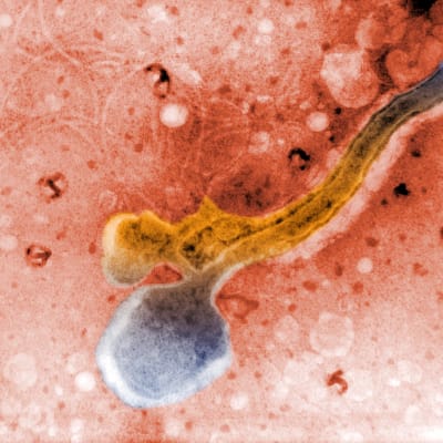  Mikroskooppikuva Treponema pallidum -bakteerista.