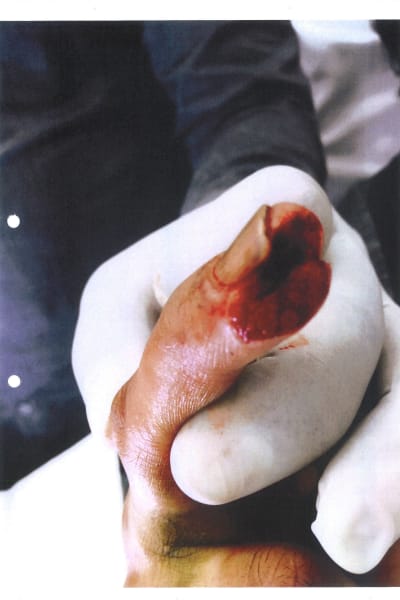 En närbild av ett blodigt finger.