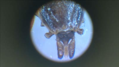 En fästing under ett mikroskop.