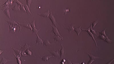 Ljusmikroskopibild på U2 osteosarkomaceller som behandlats med SM253, en möjlig inhibitor av värmechockprotein-90.
