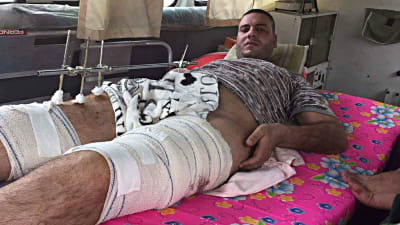 Mohammed Manteer på sjukhus i Bagdad.