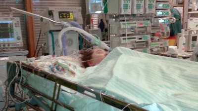 Ett barn ligger och sover i en sjukhussäng. Hon har en massa slangar och sladdar kopplade till sig. 