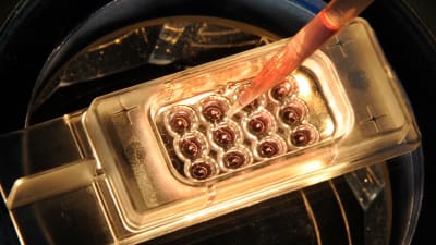 Embryon vid en klinik i Lepzig 2011
