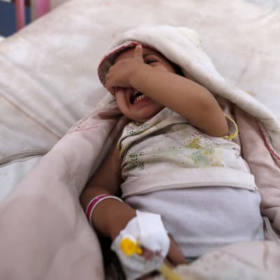 Barn som insjuknat i kolera i Jemen.