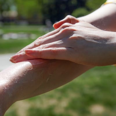 Aurinkovoidetta levitetään käsivarrelle.