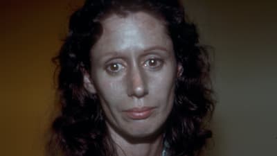 Rosemary Jacobs på 1970-talet innan en läkare skalade av huden i hennes ansikte.
