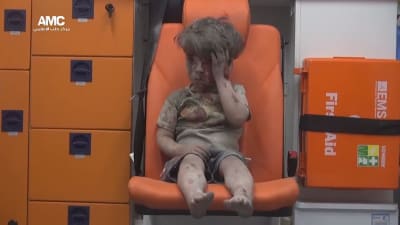 Bild av ett barn som sitter i ambulans efter att ha skadats i en flygräd mot ett rebellkontrollerat område i Aleppo i Syrien. Bilden har publicerats av en grupp som motsätter sig den syriska regeringen.