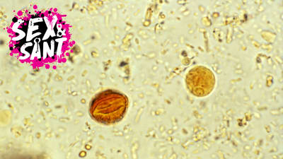 en när bild på cystor bakterie
