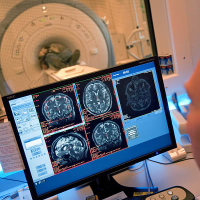 Läkare följer med patientens hjärna under datortomografin.