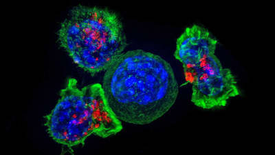 Immunförsvaret attackerar cancercell.