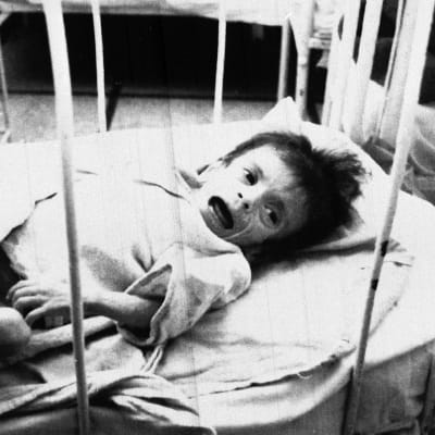 Föräldralöst barn på AIDS-avdelningen på sjukhus i Bukarest, Rumänien 1990