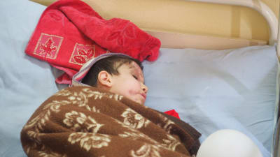 Sexåriga Shayma på sjukhus vid syriska gränsen.