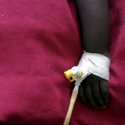 Ett undernärt barn får hjälp i Wajir i nordöstra Kenya 20.1.2006