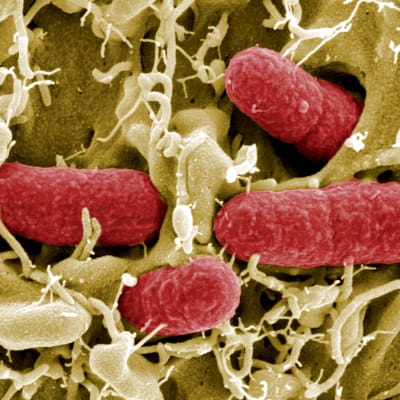 ESBL-bakterier i mikroskop