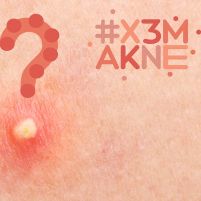 Närbild på finne med frågetecken och #x3makne logo.