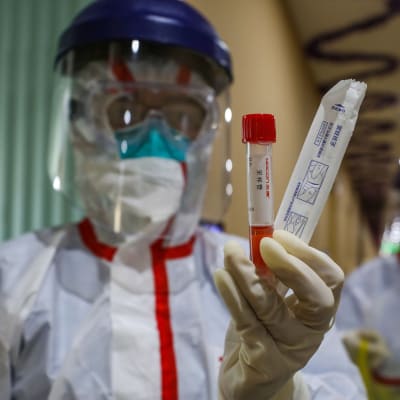En läkare i skyddsutrustning håller i ett provrör som är ett test för coronaviruset. I bakgrunden syns en annan läkare, även i skyddsutrustning. 