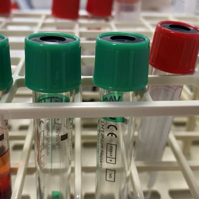 Koeputkia telineessä Hämeen ammattikorkeakoulun terveysalan opintojen harjoittelutiloissa.