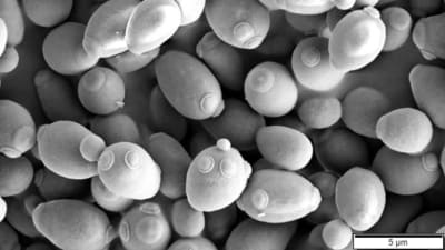 Jästsvampar (saccharomyces cerevisiae) i närbild.