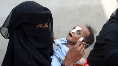En jemenitisk kvinna med ett undernärt barn i famnen väntar på mathjälp i Hodeidah den 30.5.