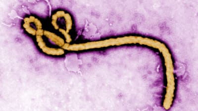 Ebolaviruset