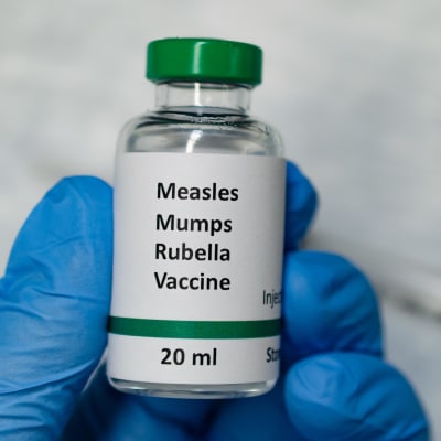 En hand håller i en flaska med MPR-vaccin, ett kombinationsvaccin för mässling, påssjuka och röda hund. 