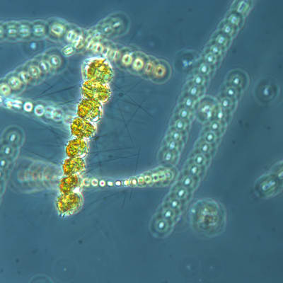 mikroskopbild av plankton