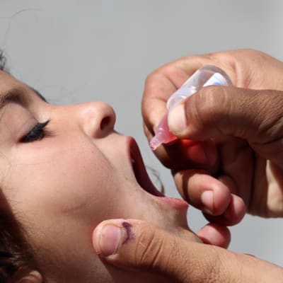 Tyttö saa poliorokotetta Pakistanissa.